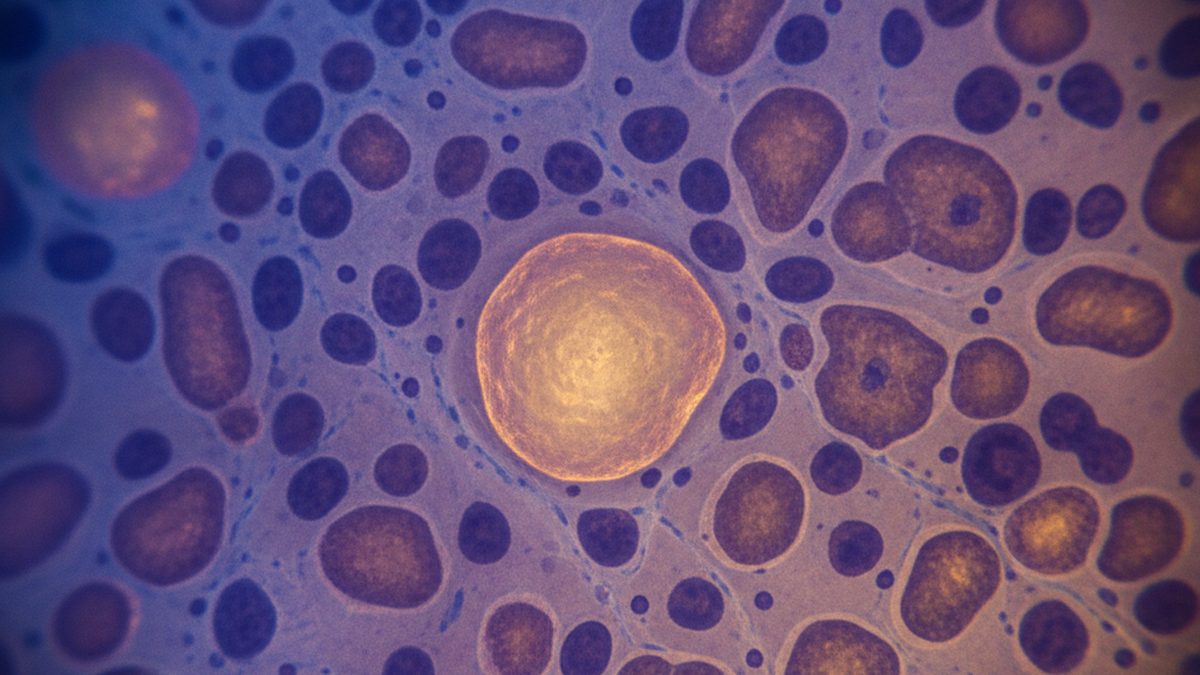 Macro view of aged human tissue under a microscope with a few glowing senescent zombie cells among healthy cells, illustrating how senolytics clear senescent cells